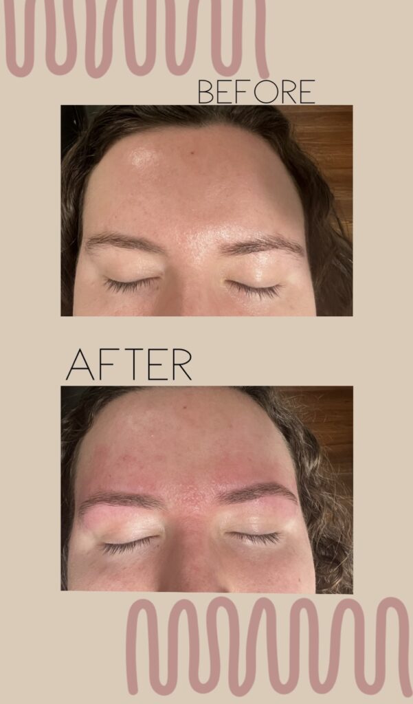 Before and after eyebrow shaping shown from the front